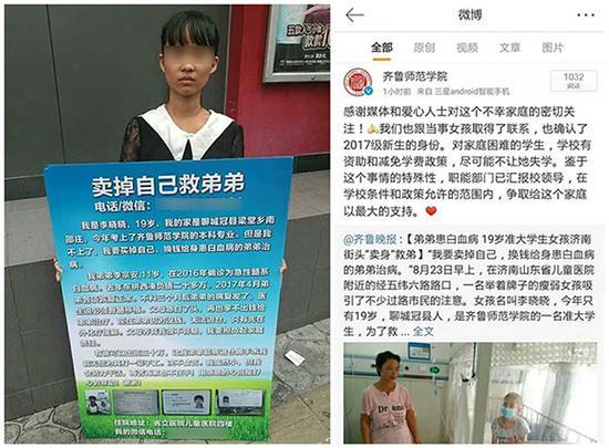聊城準大學(xué)生欲賣己救弟續(xù)：父母骨髓配型成功 已籌款20萬