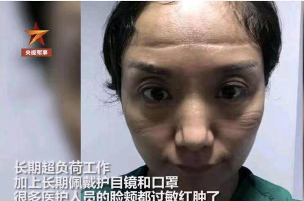 “當醫(yī)生摘下口罩的瞬間”，戰(zhàn)“疫”中的她們最美！